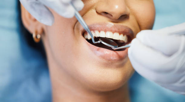 Best Dental Fillings (Composite and Amalgam)  in Manteno, IL