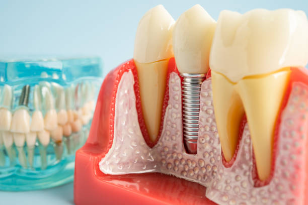 Best Cosmetic Dentistry  in Manteno, IL